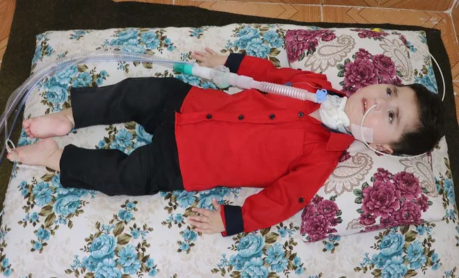 26 aylık SMA hastası bebeğin ailesi destek bekliyor