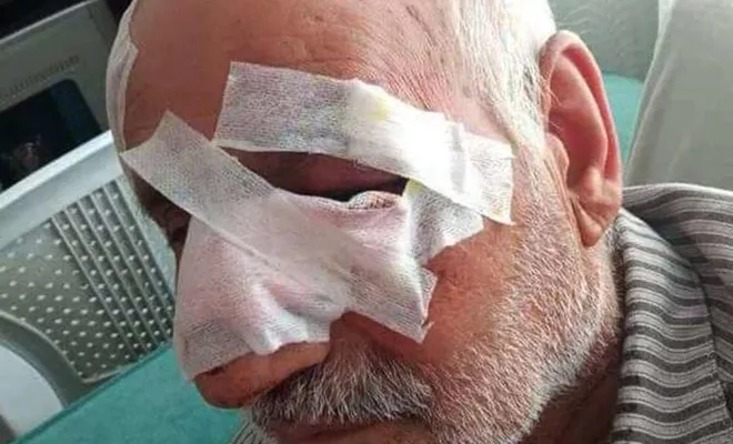 Köpek saldırısında yaralanan adam 52 gün sonra hayatını kaybetti 