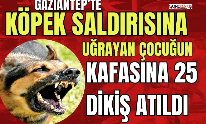 Köpek saldırısına uğrayan çocuğun kafasına 25 dikiş atıldı