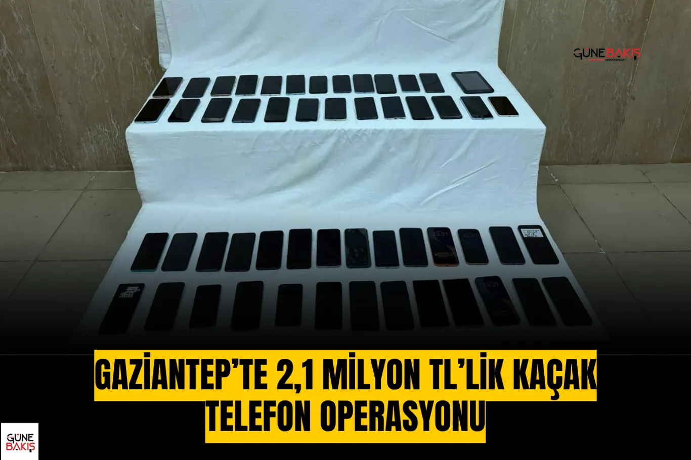 Gaziantep Şehir Hastanesi’nde dev böbrek başarıyla çıkarıldı: 8,5 kiloluk kitle 30 dakikada alındı