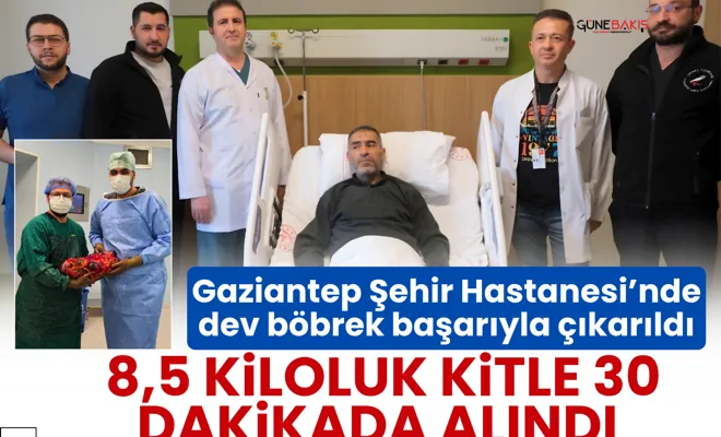 Gaziantep Şehir Hastanesi’nde dev böbrek başarıyla çıkarıldı: 8,5 kiloluk kitle 30 dakikada alındı