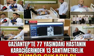 Gaziantep Şehir Hastanesi Yanık Merkezi’nde 25 bin hastaya hizmet